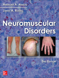 Neuromuscular Disorders 2nd Edition by Anthony A. Amato; James A. Russell – PDF ebook