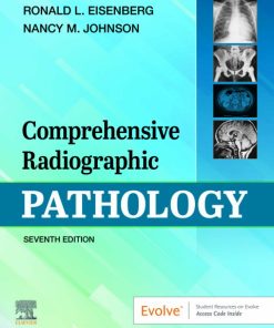 Comprehensive Radiographic Pathology 7th Edition – PDF ebook