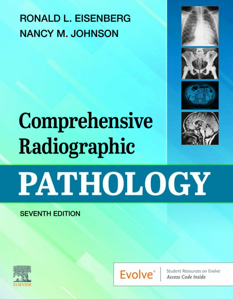Comprehensive Radiographic Pathology 7th Edition – PDF ebook Comprehensive Radiographic Pathology 7th Edition – PDF ebook