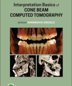 Interpretation Basics of Cone Beam Computed Tomography 2nd Edition – PDF ebook